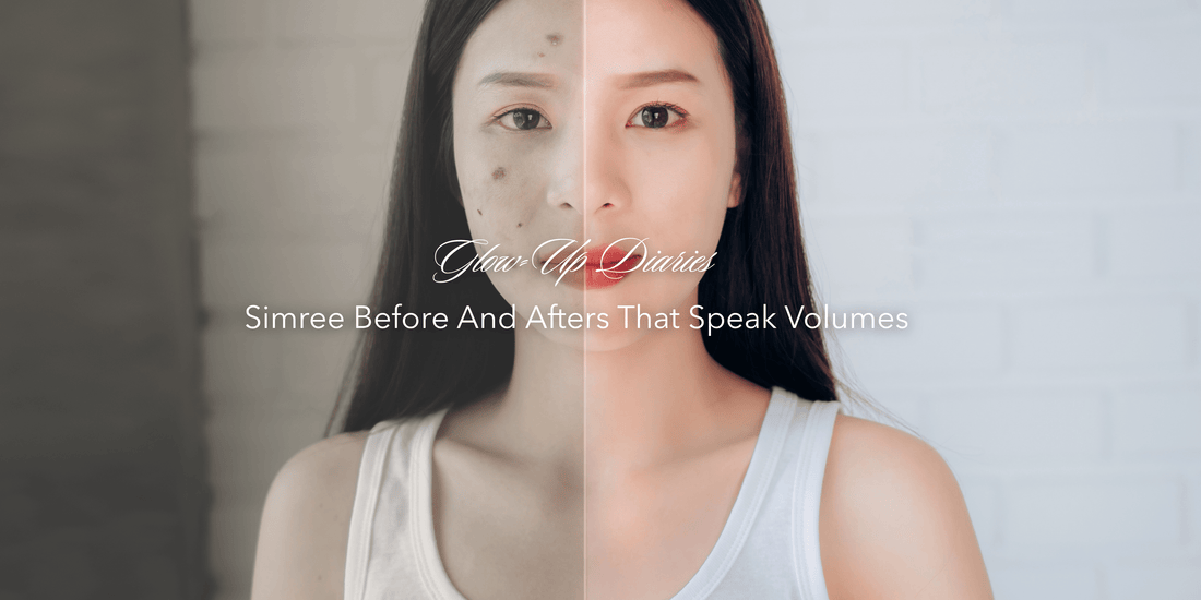 Glow-Up Diaries: Simree Before & Afters That Speak Volumes - SIMREE
