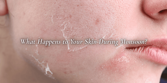 Say Bye Bye Greasy, Here’s Your Simple Monsoon Skin Care Guide - SIMREE