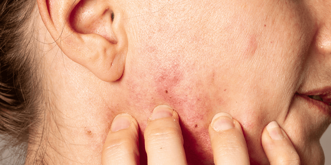 Skincare Red Flags: What Sensitive Skin Should Never Tolerate—Simree's Guide - SIMREE
