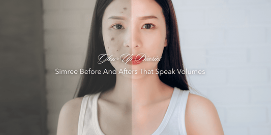 Glow-Up Diaries: Simree Before & Afters That Speak Volumes - SIMREE