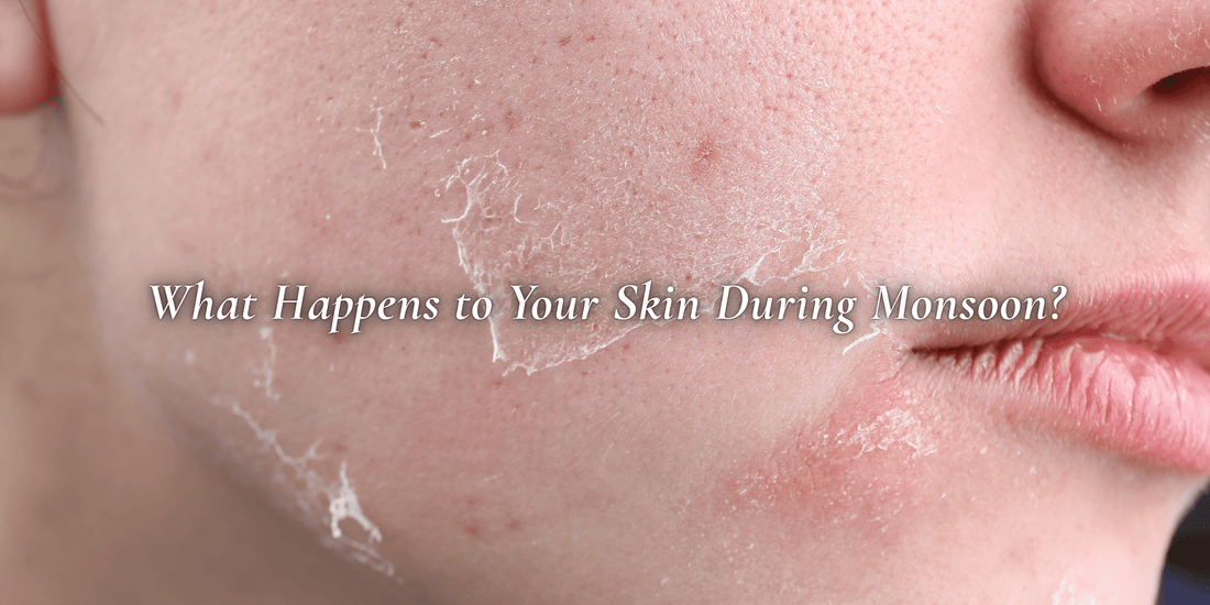 Say Bye Bye Greasy, Here’s Your Simple Monsoon Skin Care Guide - SIMREE